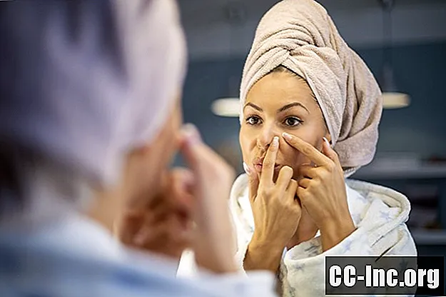 Types d'imperfections ou de comédons d'acné non enflammés - Médicament