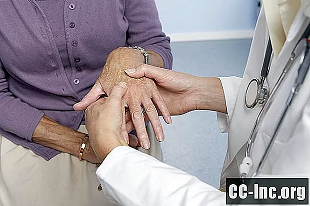 ¿Es la glucosamina un tratamiento beneficioso para la artritis?
