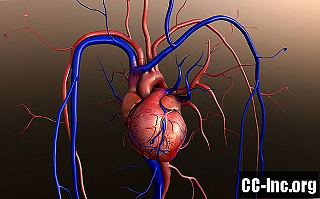 Förstå hjärttransplantationer - Medicin