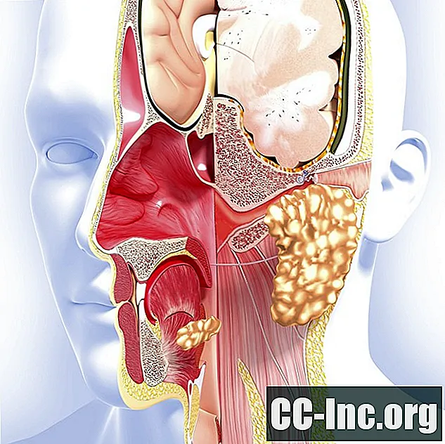 Comprensión de los cánceres de cavidad nasal y de seno paranasal
