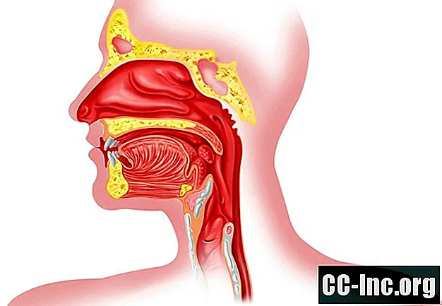 Funcția sfincterului esofagian superior și durerea de reflux acid