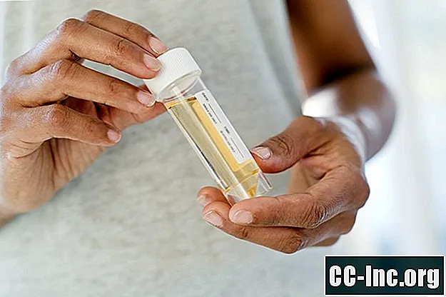 Teste de urina para doenças sexualmente transmissíveis