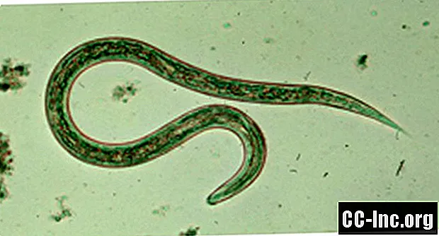 Uporaba Hookworms za zdravljenje celiakije