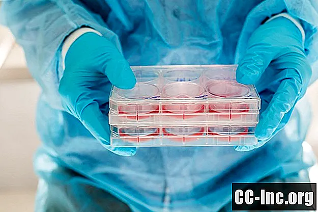 Bruk av stamceller for å kurere leddgikt og bruskskade
