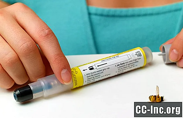 Aegunud EpiPen'i kasutamine allergiliste reaktsioonide jaoks