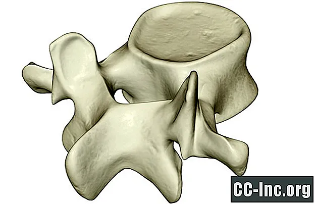 Fracturas por compresión vertebral y espinal - Medicamento