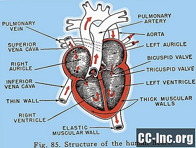 WHO klasifikacija pljučne hipertenzije