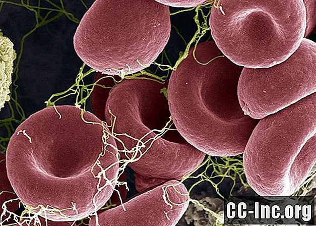 Kas yra kraujo krešuliai?