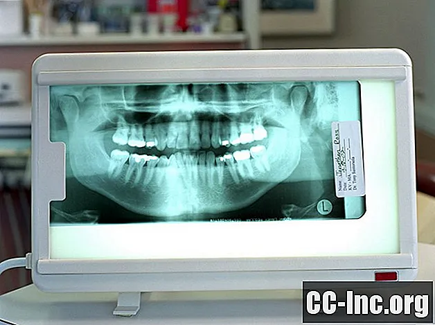 Co to jest ortodontyczna dokumentacja dentystyczna?