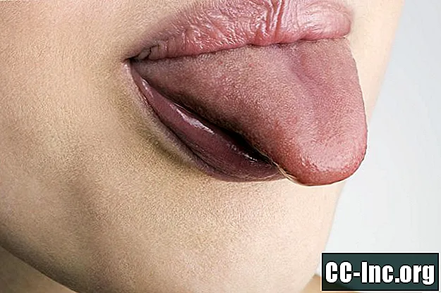 Hva forårsaker en hovent tunge?