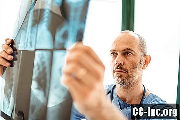 Kas ir progresējošs plaušu vēzis?