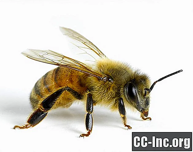 ما هو علاج لسع النحل؟