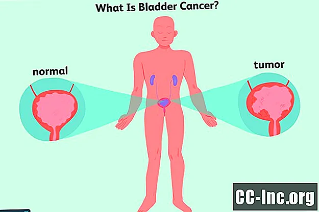 Hva er blærekreft?