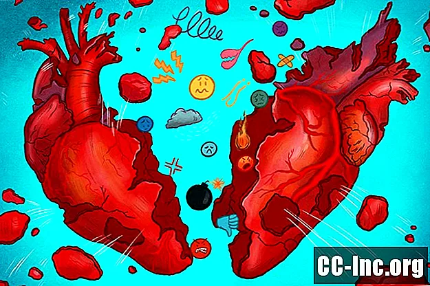 Hội chứng trái tim tan vỡ là gì?