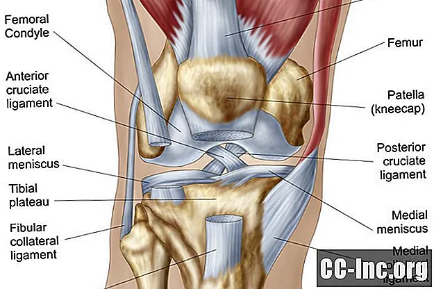 Kaj povzroča bolečine v kolenu?