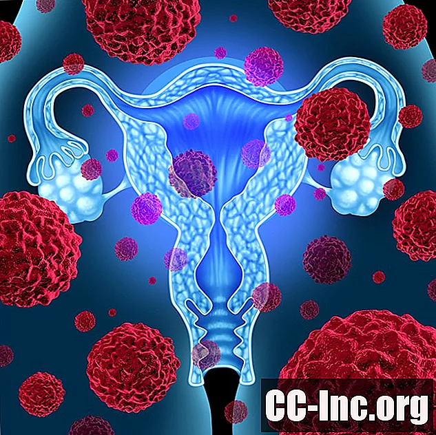 Was ist Endometriumkarzinom?