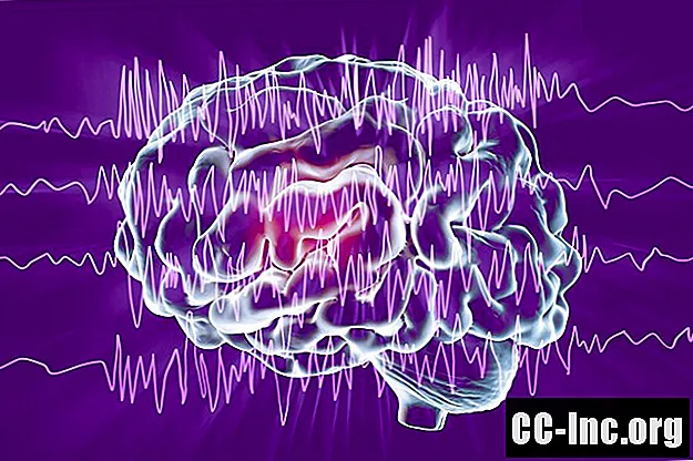 Что такое эпилепсия?
