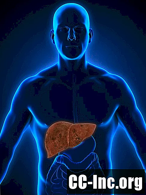 O que é doença hepática gordurosa? - Medicamento