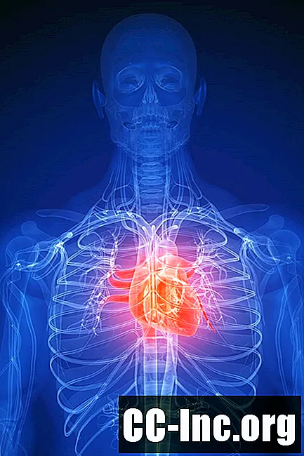 Какво представлява сърдечната болест?