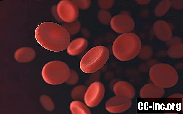 Hva er hemoglobinelektroforese?