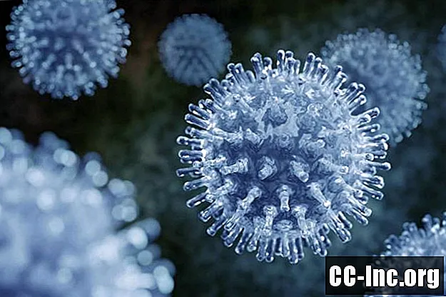 Was ist Influenza?