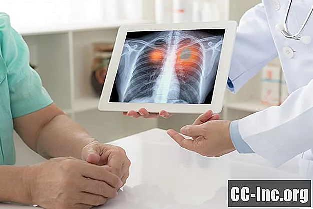 Kaj je pozitiven rak pljuč KRAS?