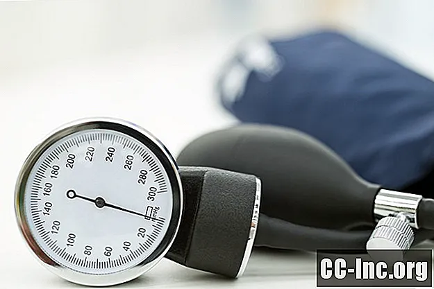 Što je nizak krvni tlak?