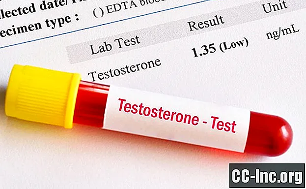 ما هو انخفاض هرمون التستوستيرون؟