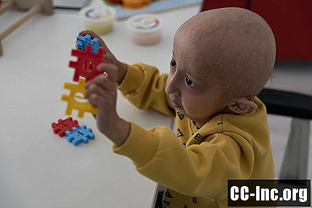 Kas yra progerija?
