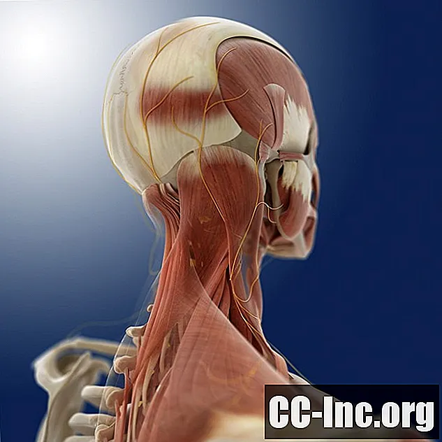 Vad är reumatoid artrit i nacken?