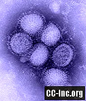 Что такое свиной грипп (H1N1)?