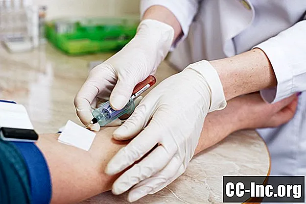 מהי בדיקת דם לסידן?