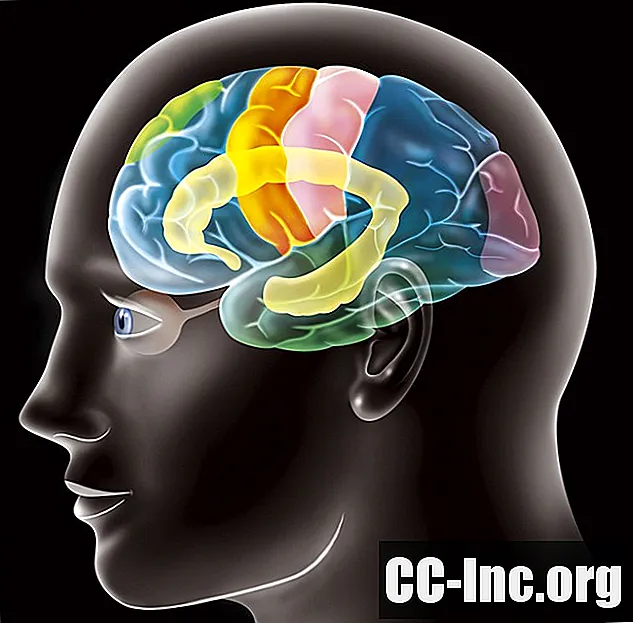 Ce este un accident vascular cerebral cortical?