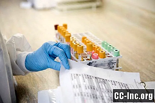¿Qué es una prueba de sangre oculta en heces (FOBT)? - Medicamento