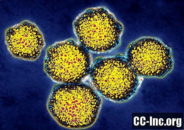 Kas yra hepatito C virusinė apkrova?