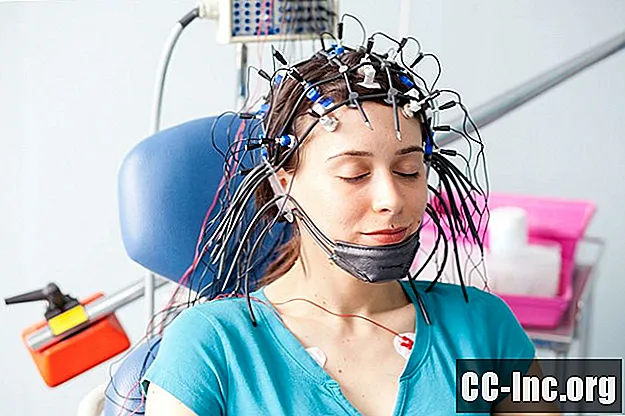 O que é um eletroencefalograma (EEG)? - Medicamento
