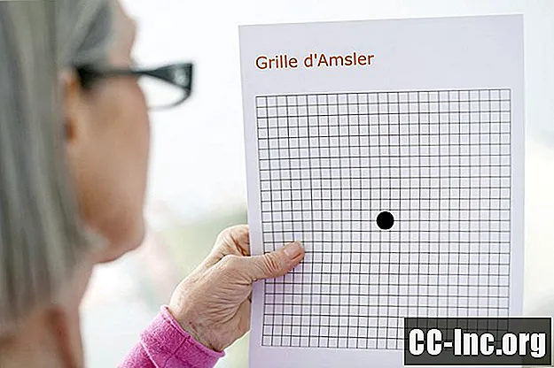 Amsler 그리드 란 무엇입니까?