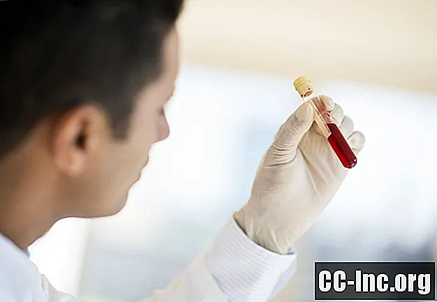 Vad är Carcinoembryonic Antigen (CEA) blodprov? - Medicin