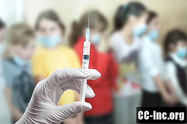 독감 전염병과 독감 유행병의 차이점은 무엇입니까?