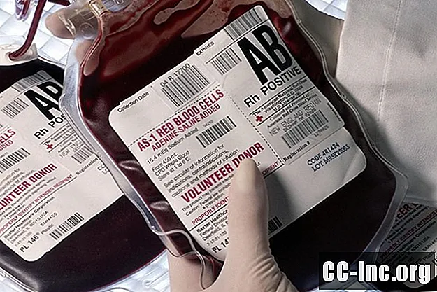 Jaka jest uniwersalna grupa krwi biorcy?