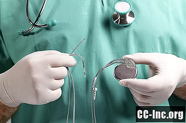Što biste trebali znati o pacemakerima