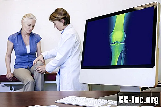 Ce que signifie un diagnostic d'arthrose tricompartimentale - Médicament