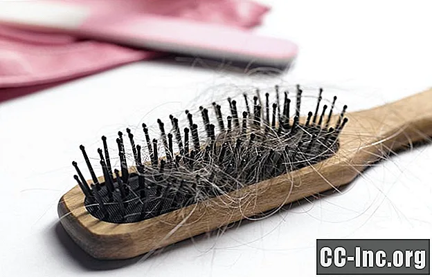 Cosa sapere sull'attaccatura dei capelli sfuggente per uomini e donne - Medicinale