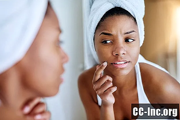 Doenças e condições comuns de pele explicadas