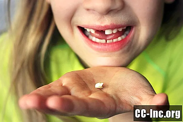 Коли випадають дитячі зубки у дитини?