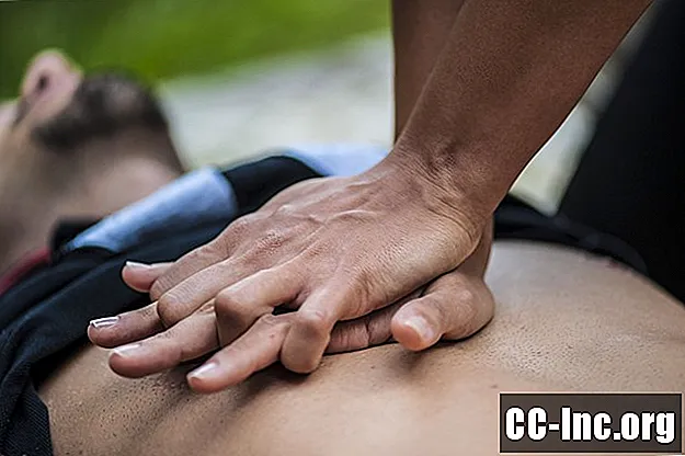 Kada sustabdyti CPR, jei jis neveikia?