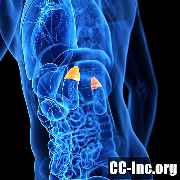 Когато ракът на белия дроб се разпространи в надбъбречните жлези