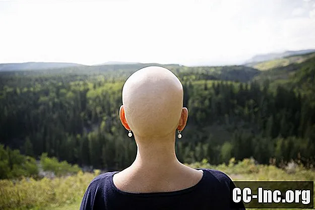 Kdaj boste izgubili lase med kemoterapijo?