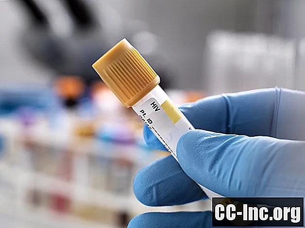 Welke hiv-tests zijn het meest nauwkeurig?