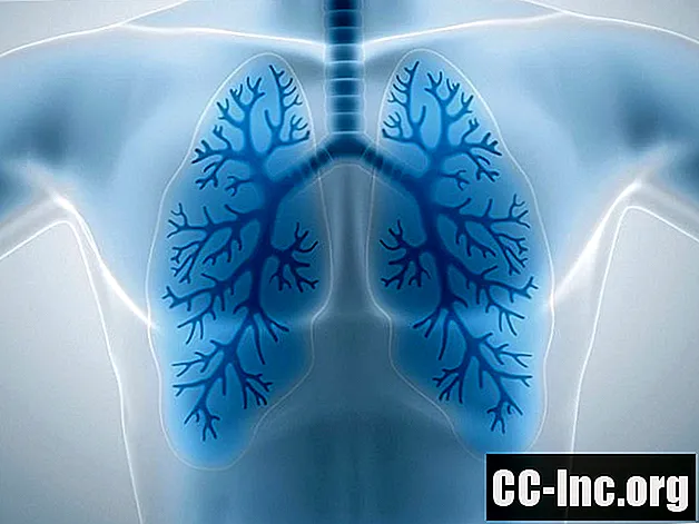 Miksi COPD ja sydämen vajaatoiminta kulkevat käsi kädessä - Lääke